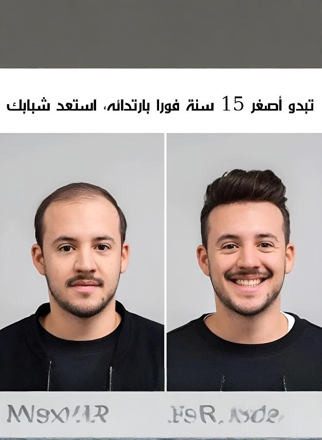 Men's Volumizing Hair System: Achieve a Natural, Youthful Look with Multiple Styles - Image 4